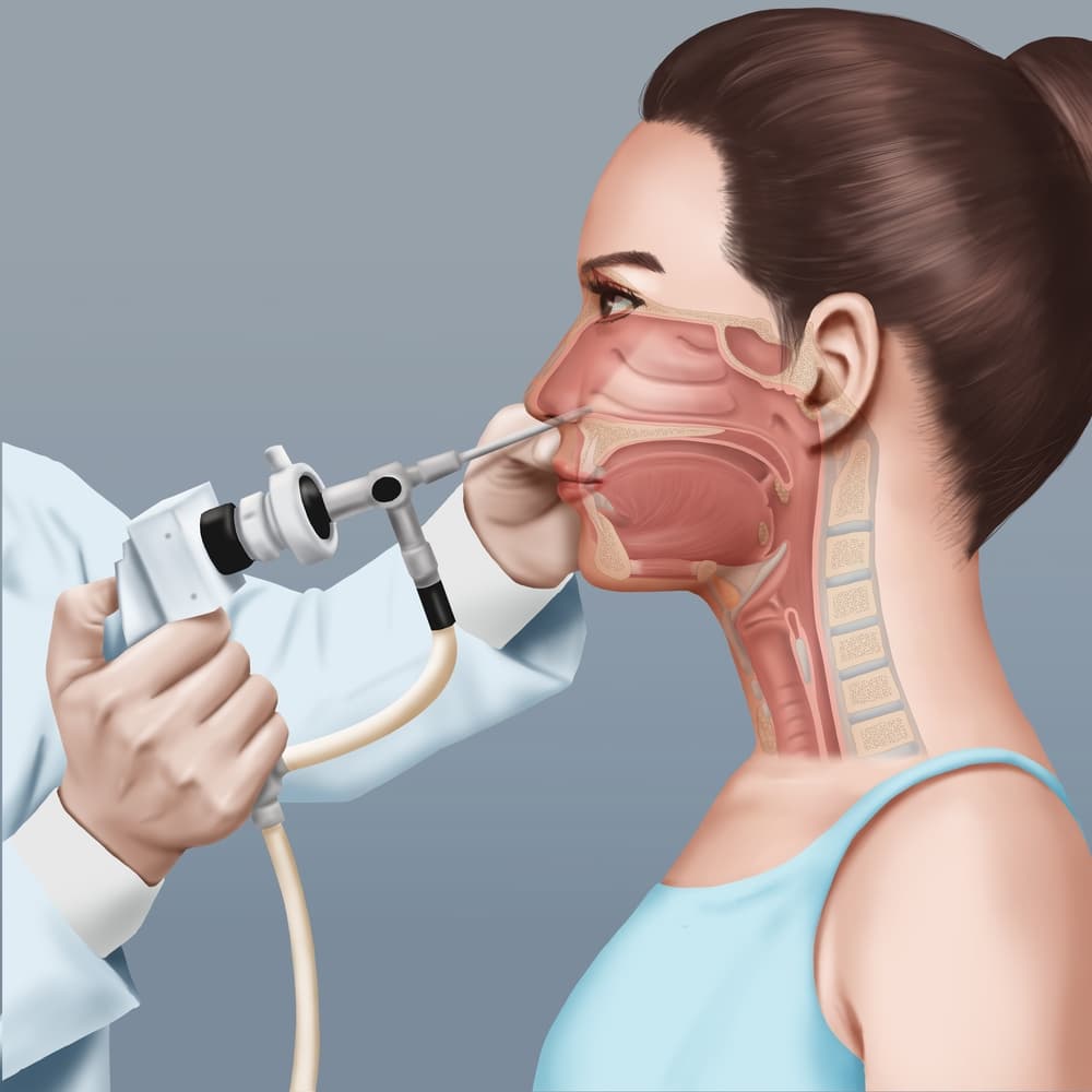 nasal-endoscopy-stock-image-m442-0061-science-photo-library